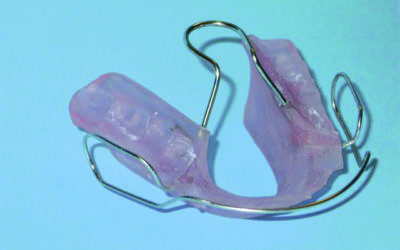 Ganzheitliche Kieferorthopädie – Bionator